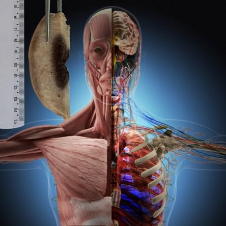 Anatomia E Patologia Associada